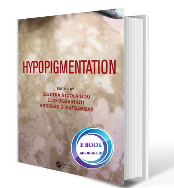 دانلود کتابHypopigmentation  2020 (Original PDF)